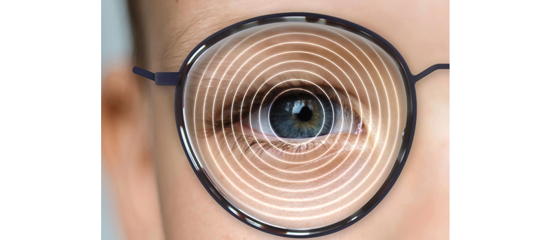 Myopia Control